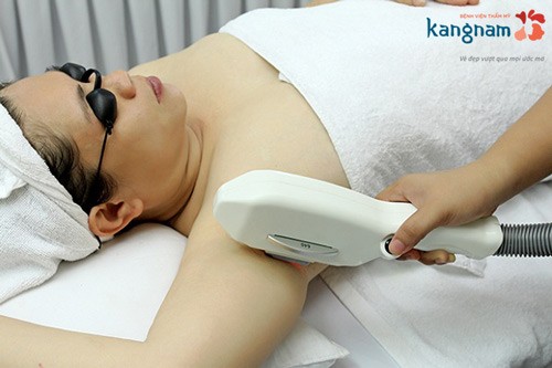 Tẩy lông nách nam giới vĩnh viễn bằng công nghệ laser Tẩy lông nách nam giới vĩnh viễn bằng công nghệ laser