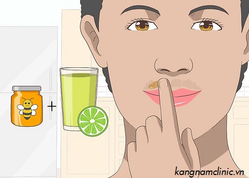 cách tẩy ria mép bằng mật ong 