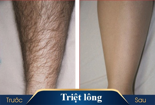 lông tài trên cơ thể