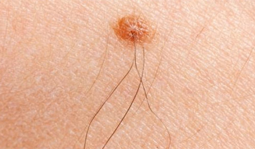 lông tài mọc ở đâu thì tốt
