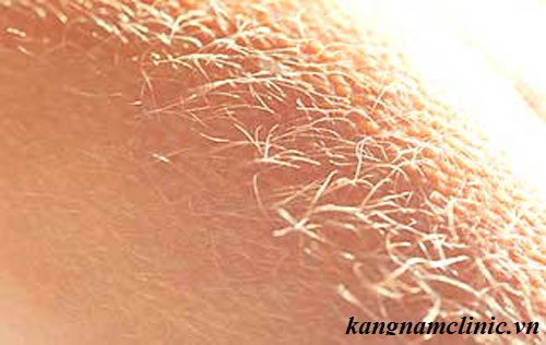 lông tay nhiều ở nữ giới