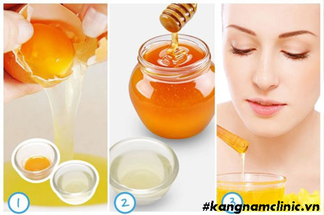 mặt nạ lòng trắng trứng gà và mật ong 
