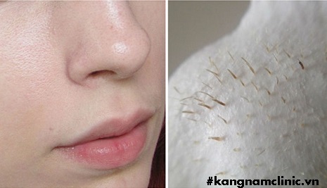 cách làm trắng da cho nam