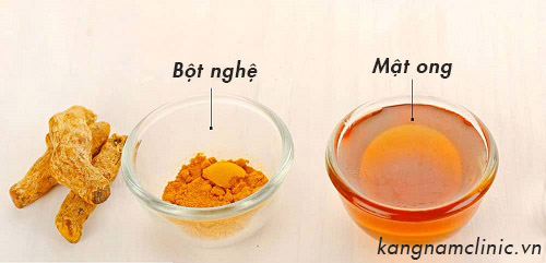 tẩy ria mép bằng bột nghệ và mật ong