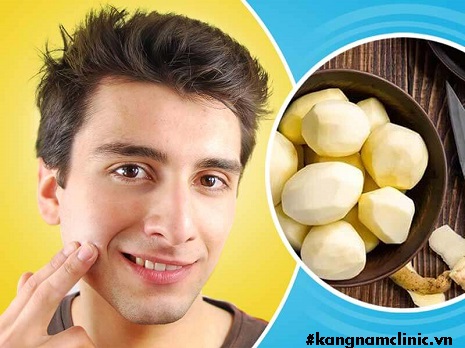Không chỉ với khoai tây, bất kỳ mặt nạ thiên nhiên nào bạn cũng không nên đắp qua đêm, điều đấy khiến da bị bí bức, không "thở" được gây mụn nhọt lưu ý khi đắp mặt nạ khoai tây